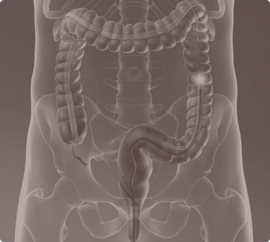 Anatomical illustration of the human colon and large intestine, focusing on the structure and layout of the digestive system.