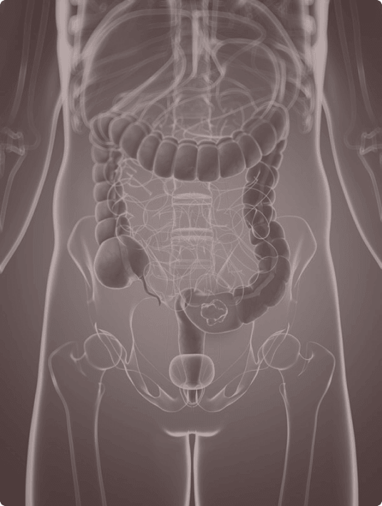 Anatomical illustration of the human digestive system, showing the intestines, colon, and pelvic region with a highlighted focus on the lower abdomen.