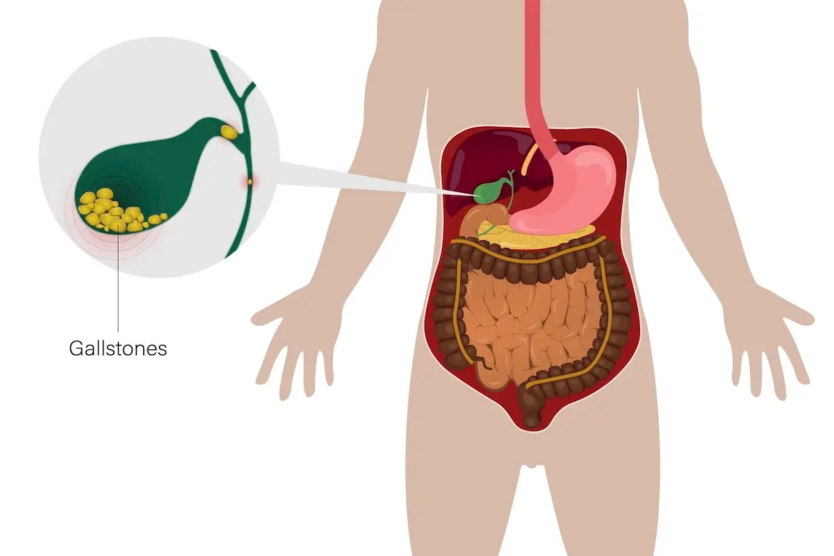 Illustration showing the function of the gallbladder