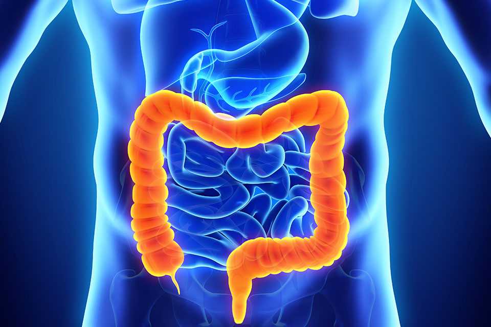 Watch Out for These 4 Serious Colon Conditions