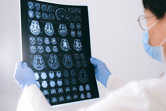 Brain-MRI