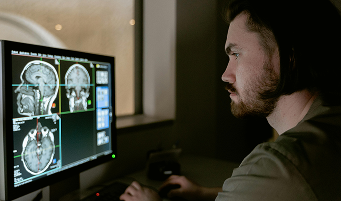 Technician reviewing brain scan to monitor signs of microvascular ischemic disease