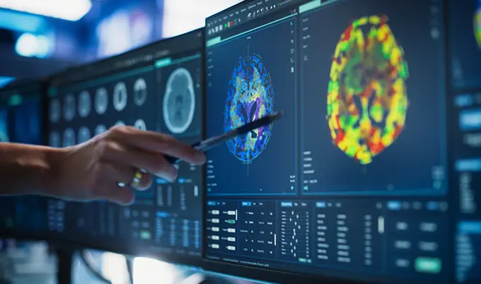 An image scan showing signs of chronic microvascular ischemic disease